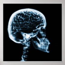 X-RAY SKULL BRAIN - BLUE POSTERS