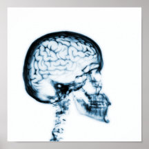 X-RAY SKULL BRAIN - BLUE PRINT