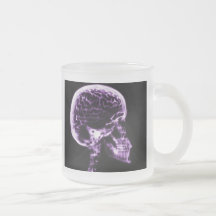 X-RAY SKULL BRAIN - PURPLE COFFEE MUG