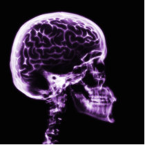 X-RAY SKULL BRAIN - PURPLE ACRYLIC CUT OUT