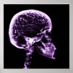 X-RAY SKULL BRAIN - PURPLE POSTER