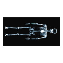 X-Ray Vision Blue Single Skeleton Photo Card Template