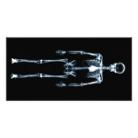 X-Ray Vision Blue Single Skeleton Photo Card Template
