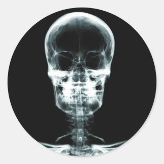X Ray Stickers | Zazzle