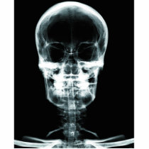 X-RAY VISION SKELETON SKULL - ORIGINAL PHOTO SCULPTURES