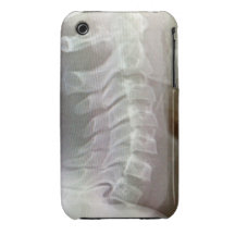 Xray cervical spine iphone cover iPhone 3 case