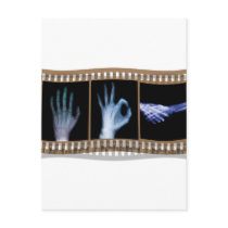 XRAY SIGN LANGUAGE FILM - HAND OK HANDSHAKE postcards by medicalpeople XRAY SIGN LANGUAGE FILM - HAND OK HANDSHAKE postcards