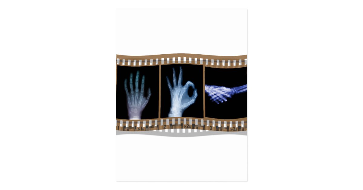 XRAY SIGN LANGUAGE FILM HAND OK HANDSHAKE POSTCARD Zazzle