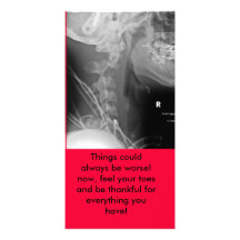 xray, Things could always be worse! now, feel y... Customized Photo Card