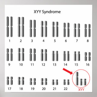 syndrome xyy genome male poster super abnormal framed artwork