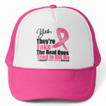 YES They're fake....My real ones tried to kill me Mesh Hat