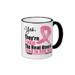YES They're fake....My real ones tried to kill me Mug