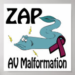 ZAP AV Malformation posters