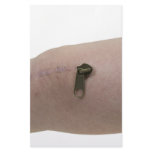 ZipperPullScar091209 Custom Stationery