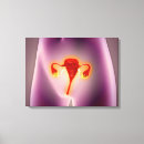 Search for female anatomy canvas prints Healthcare