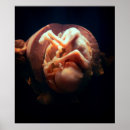 Search for pro life posters Womb