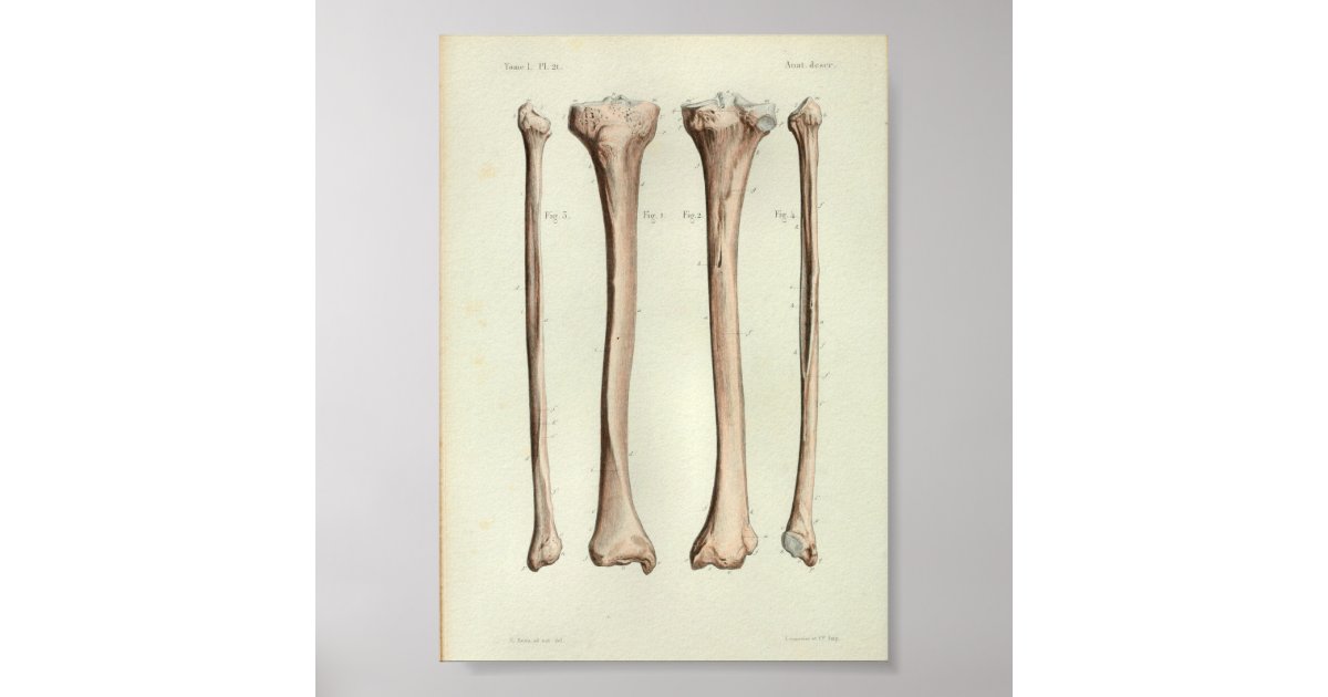 Tibia Fibia Printable 1844 Vintage Anatomy Print Tibia Fibula | Zazzle