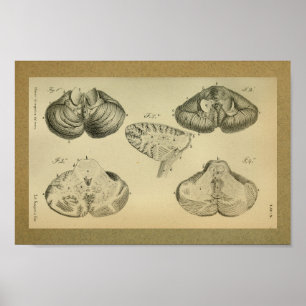 1850 Vintage Anatomy Print Brain Cerebellum