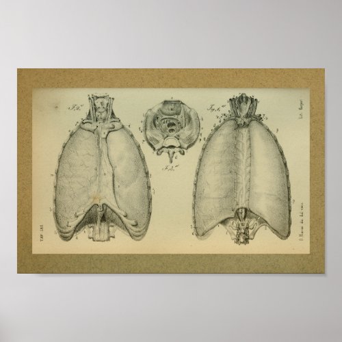 1850 Vintage Anatomy Print Lungs Pleura