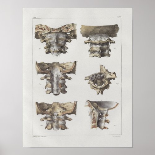 1867 Cervical Spine Vintage Anatomy Print