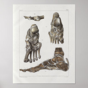 1867 Foot Bones Vintage Anatomy Print