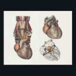 1867 Human Heart Vintage Anatomy Print<br><div class="desc">Vintage 1867 anatomical print by Dr. Bourgery. The arteries of the human heart.</div>