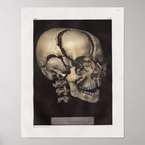 1867 Human Skull Vintage Anatomy Print