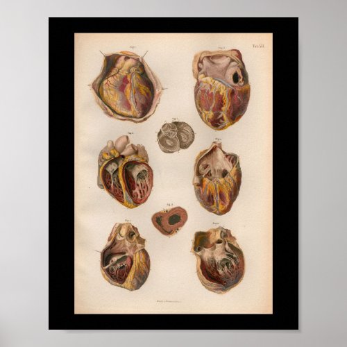 1879 Vintage Bock Anatomy Print Heart Muscles