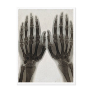 1896 X-Ray Hands Vintage Medical Postcard Repro