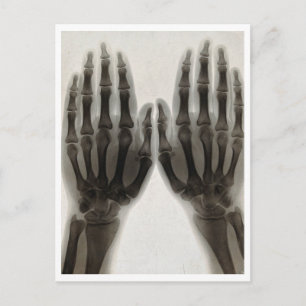 1896 X-Ray Hands Vintage Medical Postcard Repro