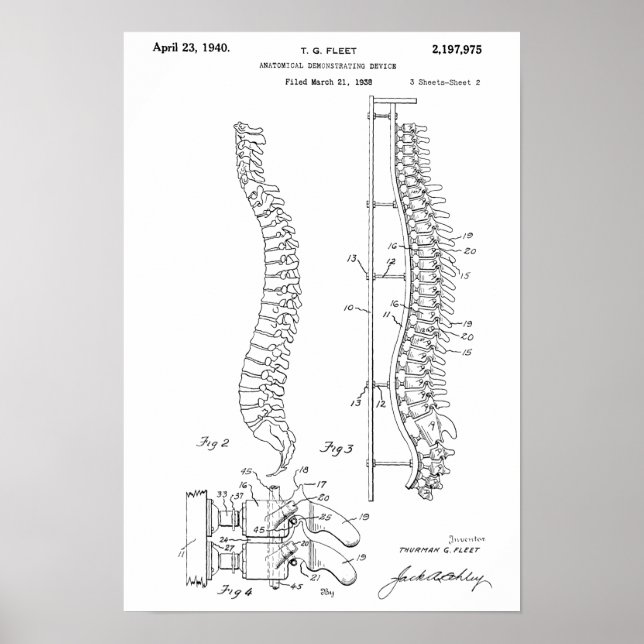 1940 Vintage Anatomical Spine Patent Art Print (Front)