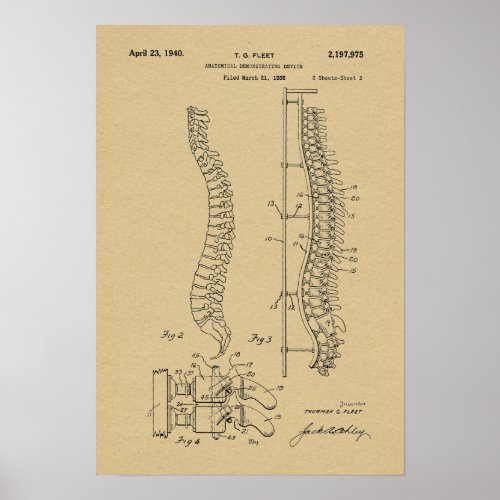 1940 Vintage Anatomical Spine Patent Art Print