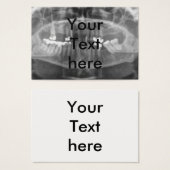 A Big Smile (Front & Back)