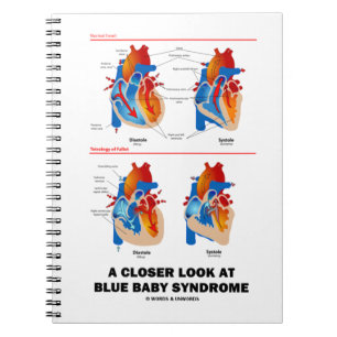 A Closer Look At Blue Baby Syndrome Heart Anatomy Notebook