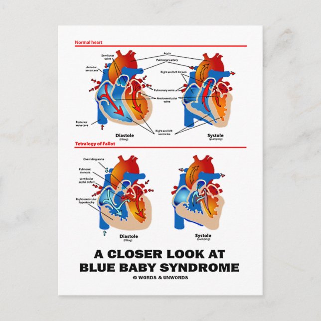 A Closer Look At Blue Baby Syndrome (Heart) Postcard (Front)