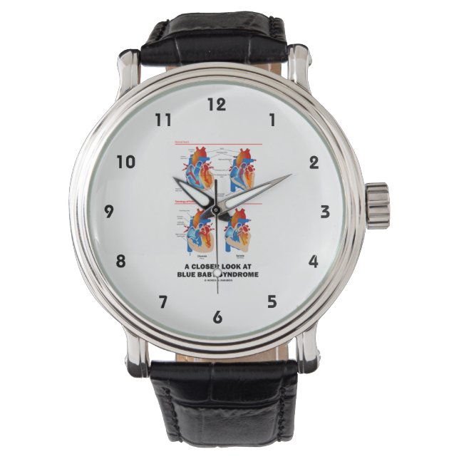 A Closer Look At Blue Baby Syndrome (Heart) Watch (Front)