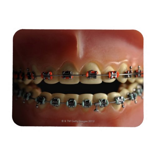 A dental model and Teeth braces Magnet