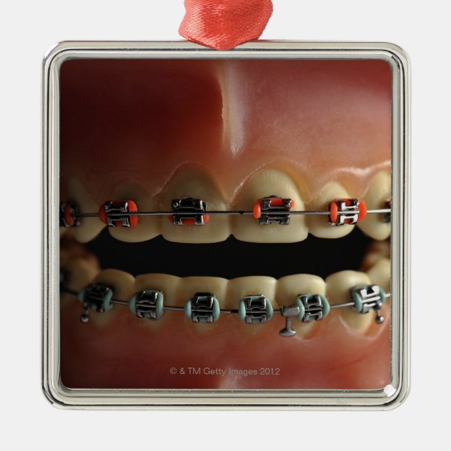 A dental model and Teeth braces Metal Ornament (Front)
