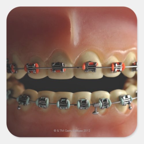 A dental model and Teeth braces Square Sticker