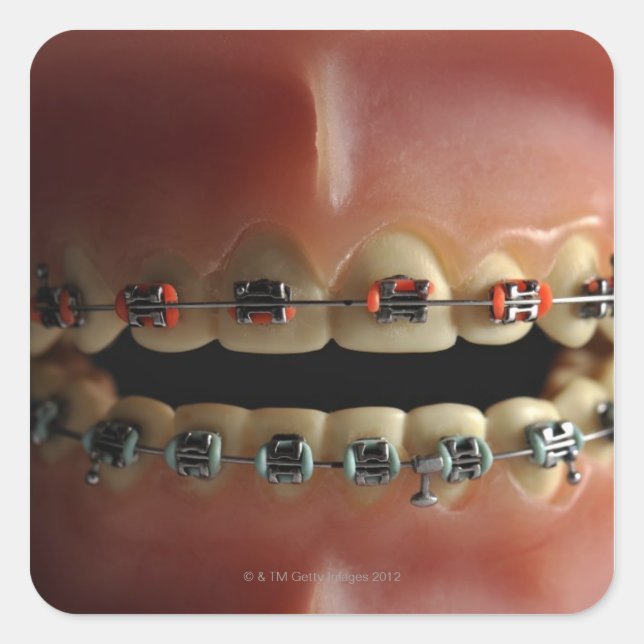 A dental model and Teeth braces Square Sticker (Front)