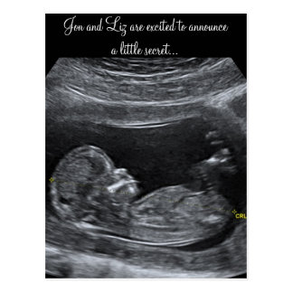 A Little Secret ~ Pregnancy Announcement Postcard