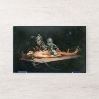 A Man's Near Death Experience & Gothic Spirits HP Laptop Skin