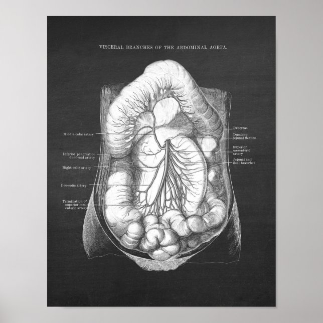 Abdominal Aorta Anatomy Poster (Front)