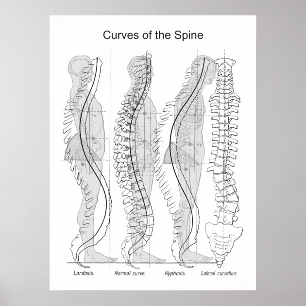 Abnormal Curves Of The Spine Poster Chiropractic | Zazzle