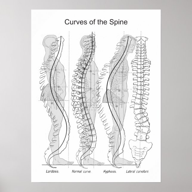 Abnormal Curves of the Spine Poster Chiropractic (Front)