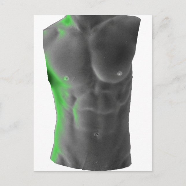 Abs Postcard (Front)