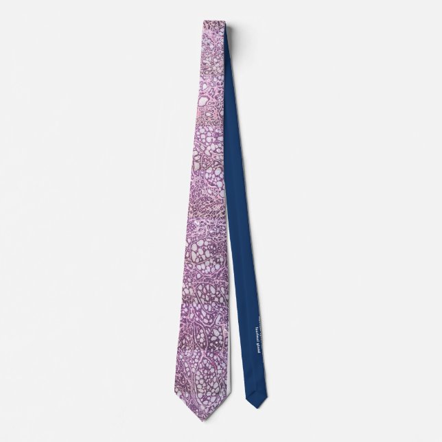 Adenoid cystic carcinoma lacrimal gland neck tie (Front)