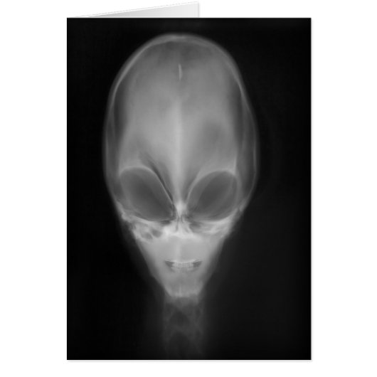 Alien Skull X-ray Cards (Front)