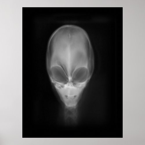 Alien Skull X_ray Poster