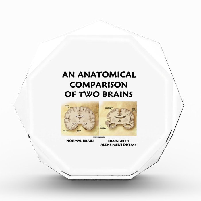 An Anatomical Comparison Of Two Brains Alzheimers Awards